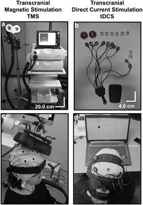 Past, Present, and Future of Non-invasive Brain Stimulation Approaches to Treat Cognitive Impairment in Neurodegenerative Diseases: Time for a Comprehensive Critical Review